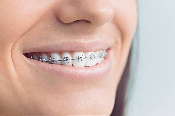 Full Mouth Reconstruction in Cosmopolis, WA